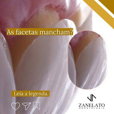 Zanelato Estética Dental | Tratamentos Odontológicos e Odontologia Digital foto 2